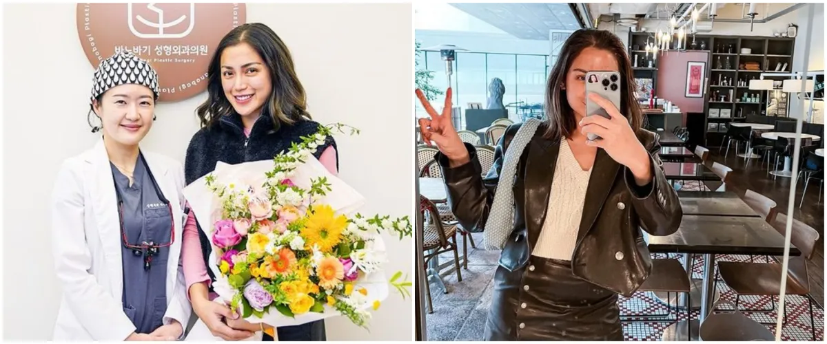 5 Potret Jessica Iskandar usai operasi hidung di Korea, penampilannya kayak beda orang