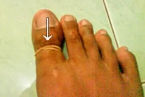 Pengobatan antimainstream ini cuma bisa ditemukan di Indonesia! 