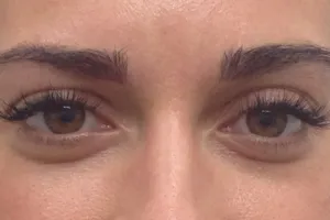 Jarak antar alis ternyata ungkap kepribadianmu, kok bisa?