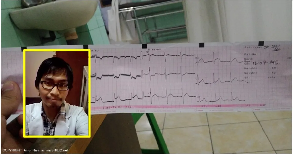 Cerita dokter hadapi perokok yang meregang nyawa ini bikin merinding