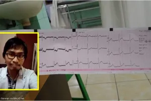 Cerita dokter hadapi perokok yang meregang nyawa ini bikin merinding