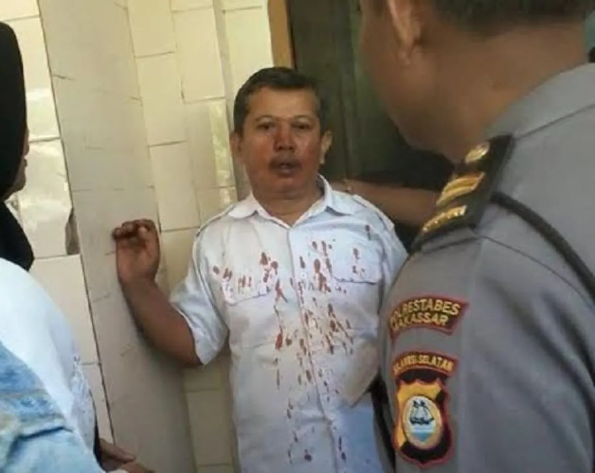 Guru korban pemukulan siswa & orangtua alami patah hidung