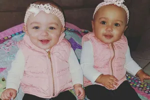 Kisah bayi kembar yang terlihat beda ras, langka tapi nyata