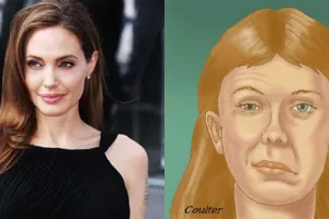 Wajah Angelina Jolie yang sebelah jadi kaku, ini ternyata penyebabnya