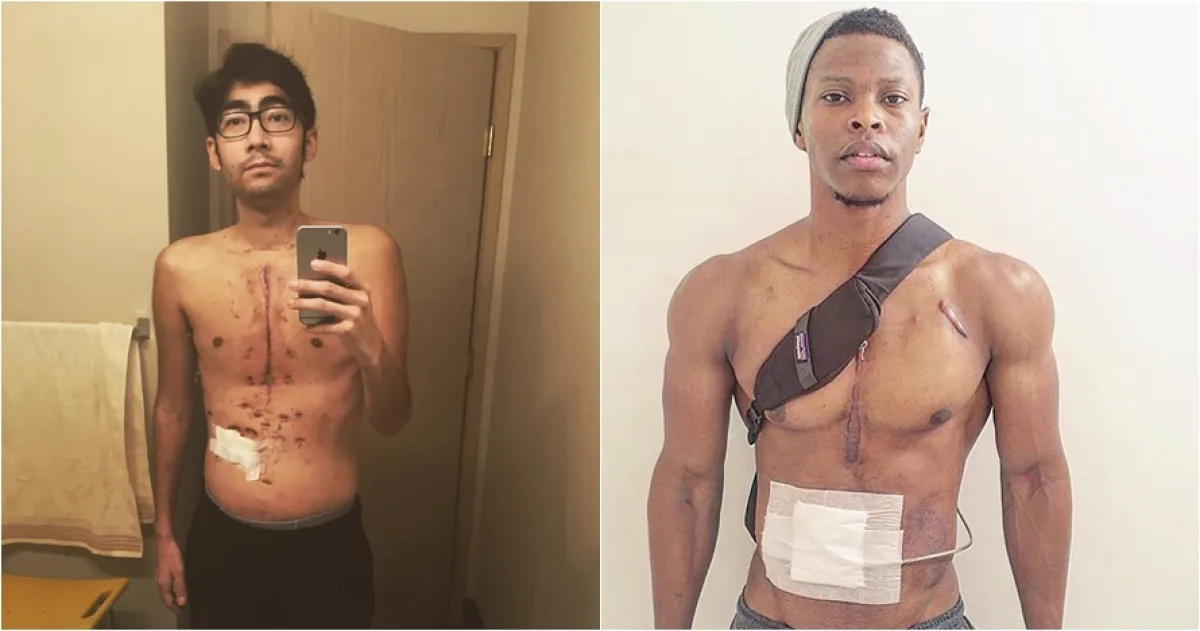 5 Potret menyentuh mereka yang hidup berkat jantung orang lain