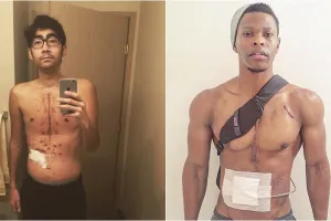 5 Potret menyentuh mereka yang hidup berkat jantung orang lain