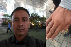 Tangan helper Bandara Soetta ini sampai  bengkak gara-gara menolak tip