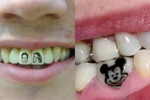 10 Kreasi tato unik di gigi, kamu berani coba?