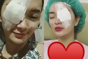 Mata kiri Zaskia Gotik diperban habis operasi, sakit apa ya?