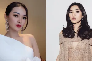 Tak hanya Zaskia Gotik, 4 seleb ini juga pernah operasi mata