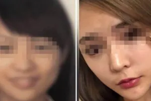 Gara-gara operasi plastik, wanita ini gagal naik pesawat