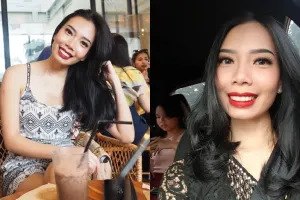 Jadi pusat perhatian, ini 10 pesona dokter cantik yang rawat Limbad