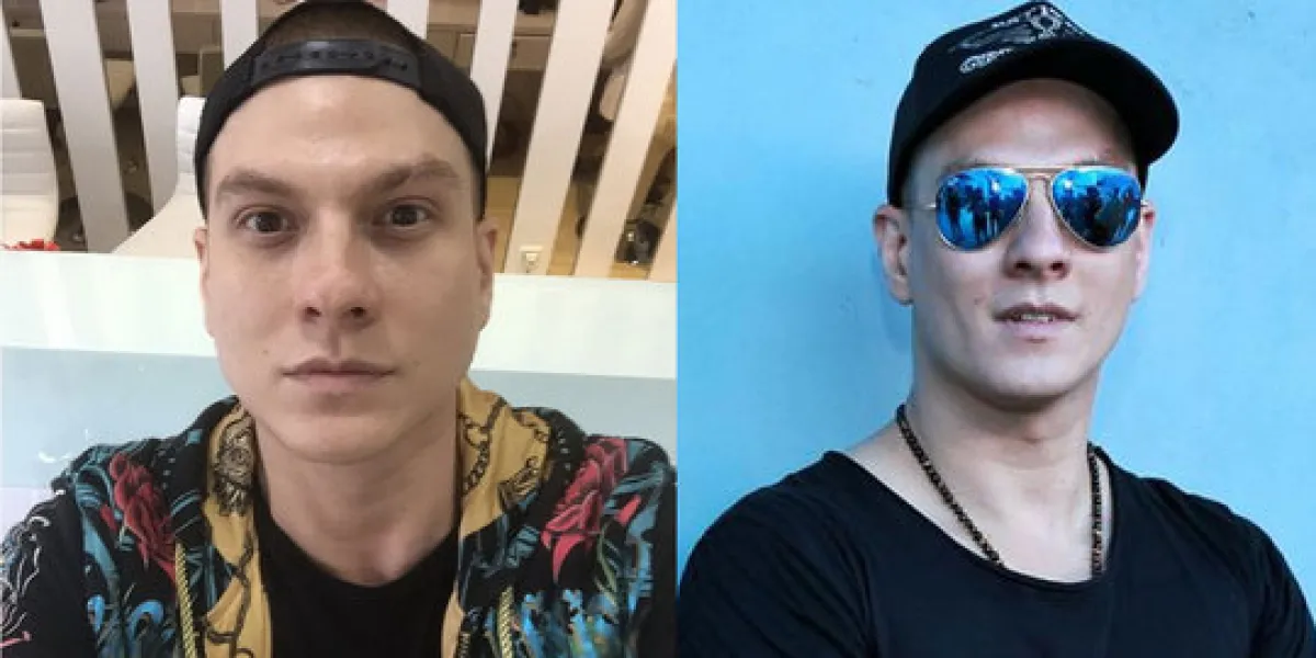 Posting foto masa kecil, hidung Bertrand Antolin jadi sorotan