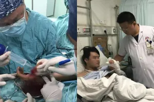 Gara-gara botol minuman soda meledak, jempol siswa ini nyaris putus