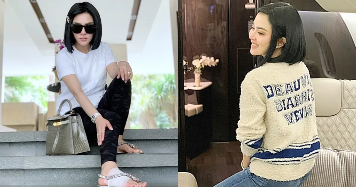 Begini penampakan kaki bengkak Syahrini usai perban dibuka