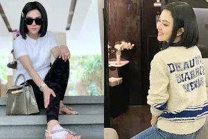 Begini penampakan kaki bengkak Syahrini usai perban dibuka