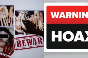 3 Fakta kabar hoax terkait cacar monyet, tetap waspada