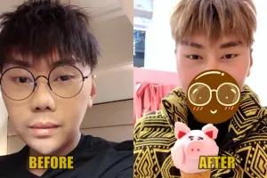 Sempat dibully, Roy Kiyoshi ungkap dirinya oplas hingga potong dagu