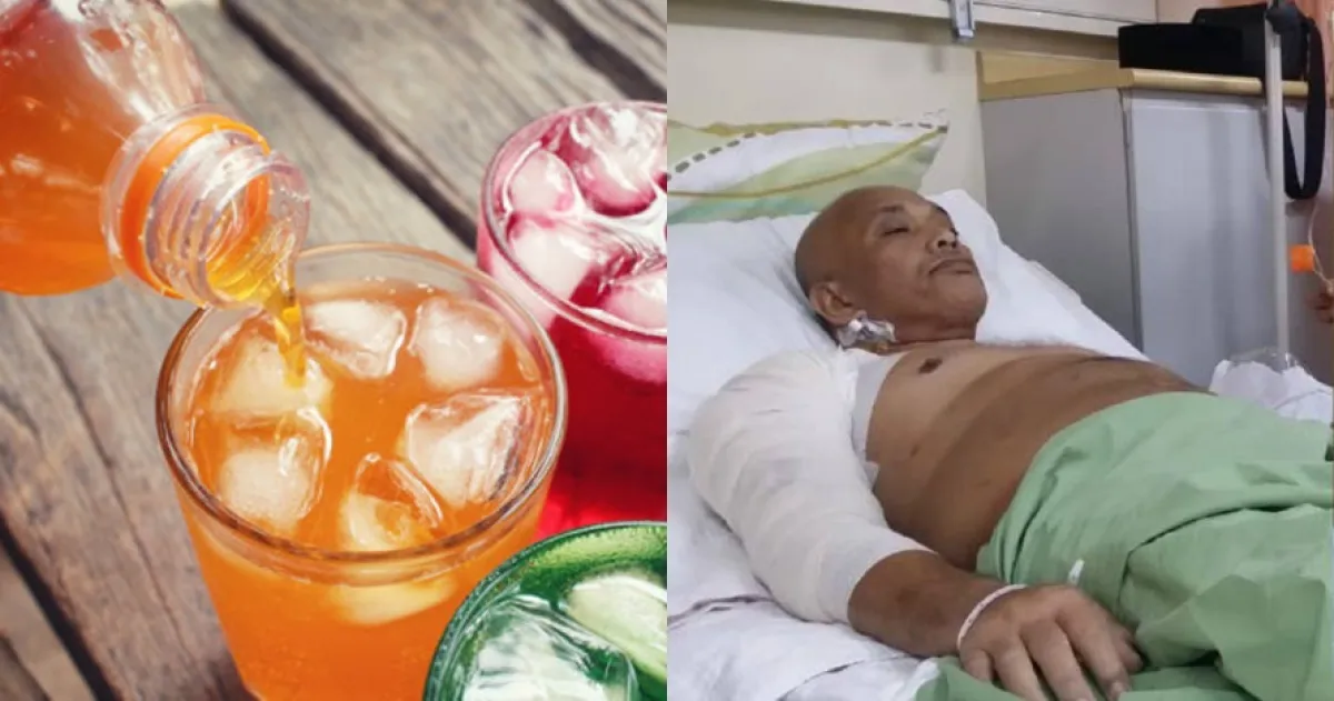 Minum soft drink setiap hari, lengan pria ini alami pembusukan
