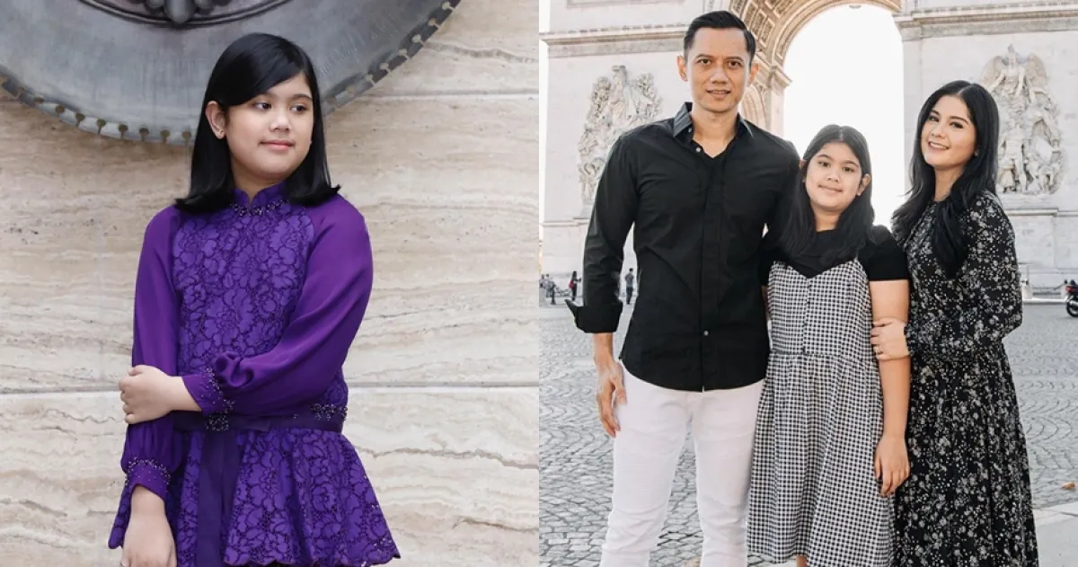 Jatuh sakit, ini potret kondisi putri Agus Yudhoyono di RS