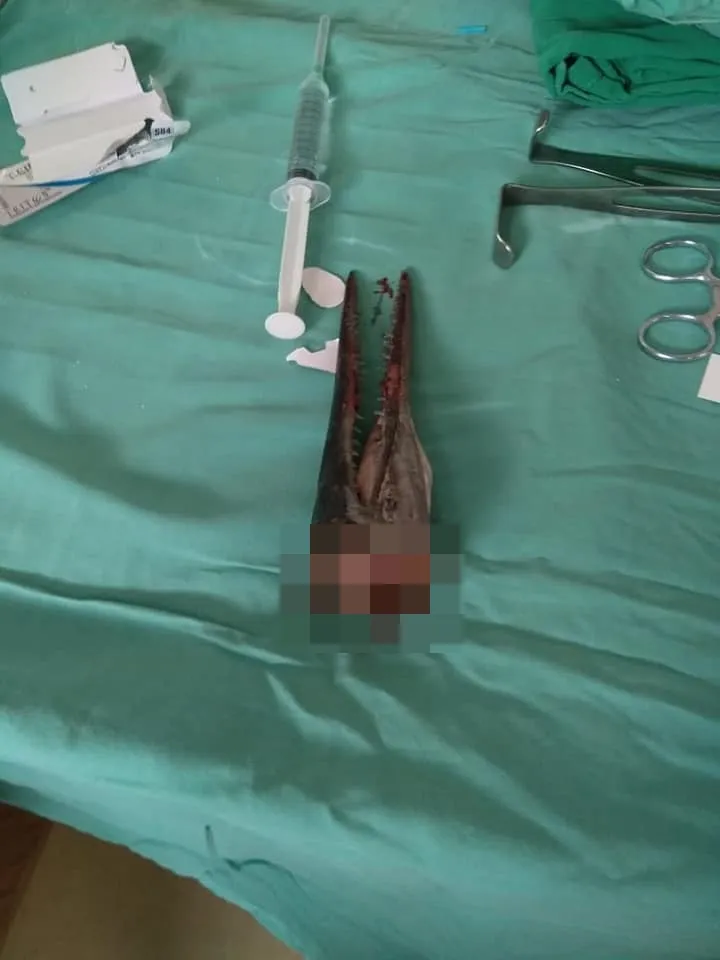 leher tertembus ikan sori © Facebook/iwan.koi.904 leher tertembus ikan sori © Facebook/iwan.koi.904