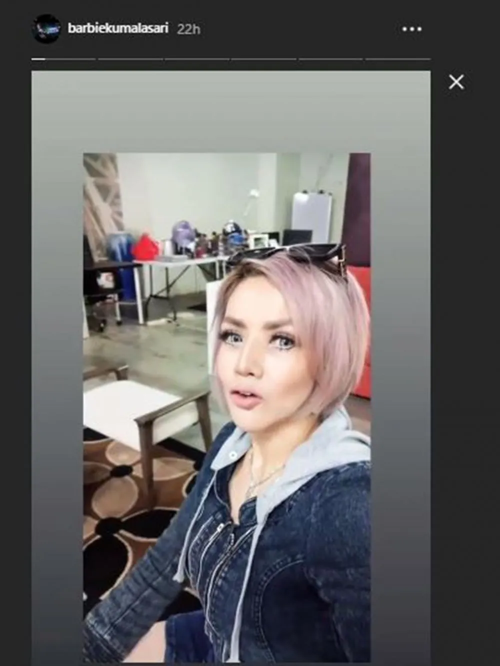 Barbie operasi hidung  Instagram 