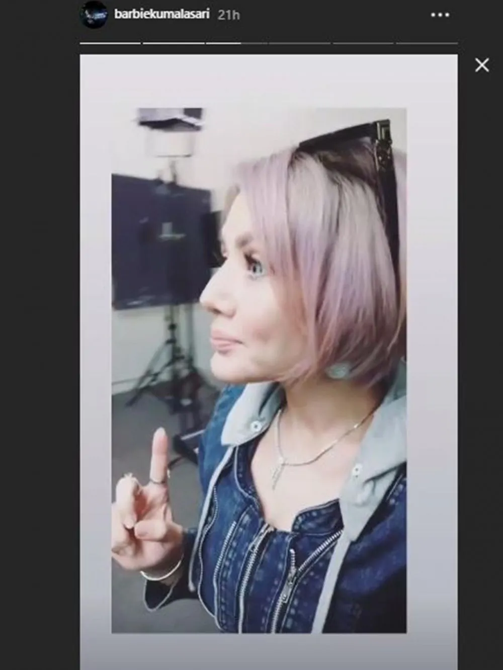 Barbie operasi hidung  Instagram 