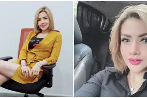 5 Foto terbaru Barbie Kumalasari usai operasi hidung, jadi sorotan