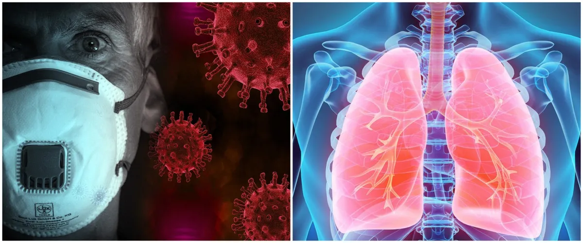 Ini yang terjadi pada paru-paru seseorang saat terinfeksi corona