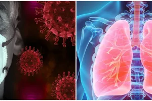 Ini yang terjadi pada paru-paru seseorang saat terinfeksi corona