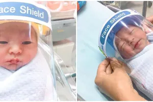 Cegah corona, bayi lahir di negara ini dipasangi pelindung wajah