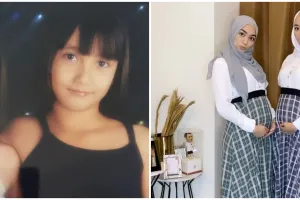 10 Transformasi Citra Kirana & Erica Putri, kompak hamil bareng