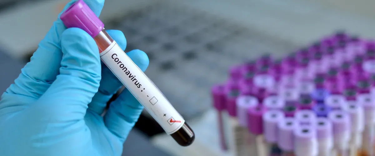 Virus corona ternyata ada tiga jenis, ini penjelasannya