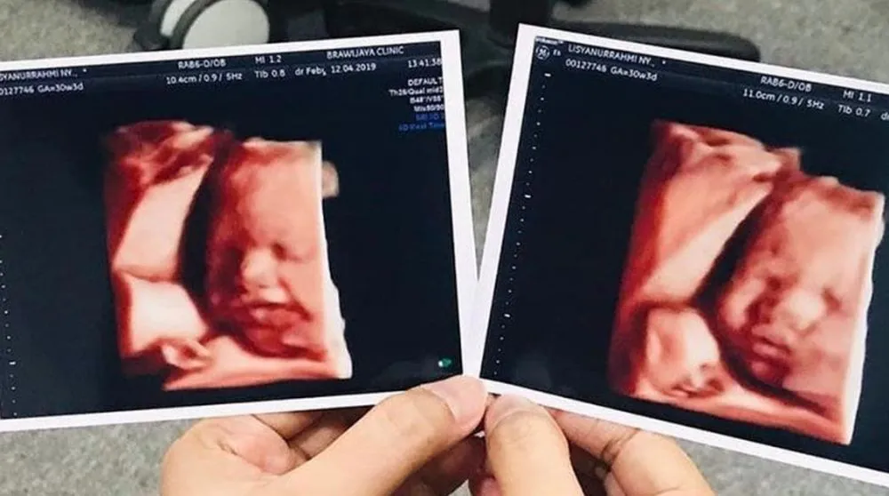 usg seleb © 2020 brilio.net usg seleb © 2020 brilio.net