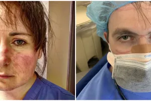 10 Potret haru tim medis usai bekerja terlalu lama, wajah penuh luka