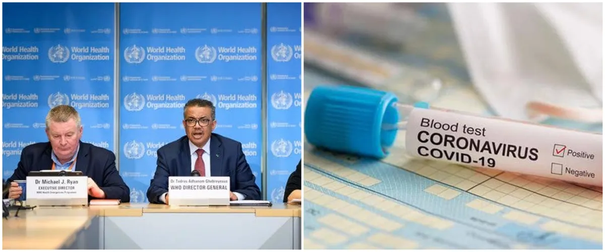 WHO: Virus corona mungkin tak akan pernah pergi