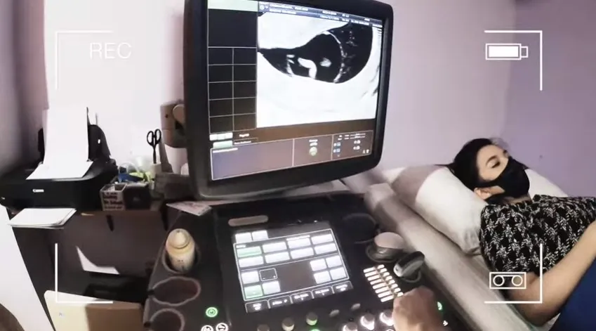 Chelsea Olivia hamil anak kedua Berbagai sumber Chelsea Olivia hamil anak kedua Berbagai sumber