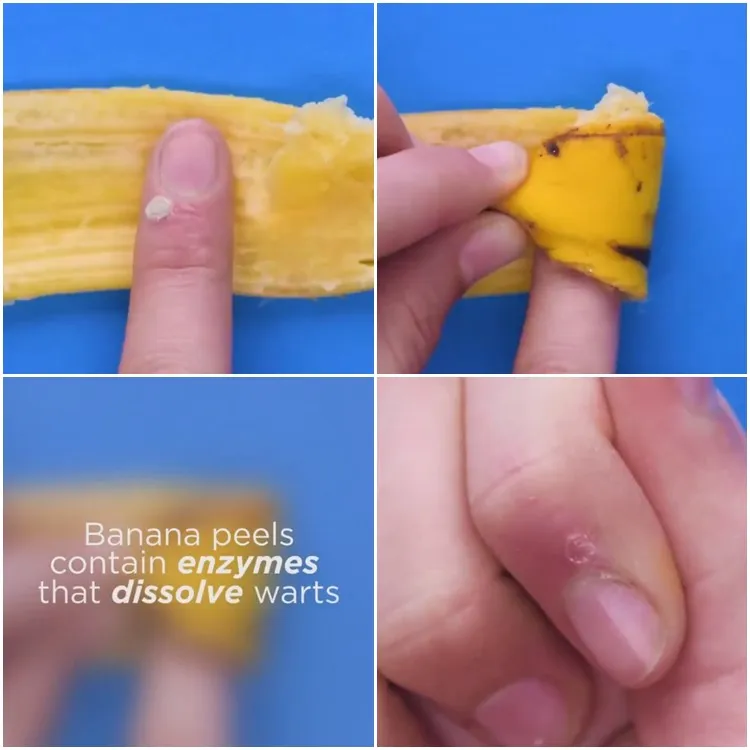 Lifehack merawat tubuh alami Twitter/@BlossomHacks