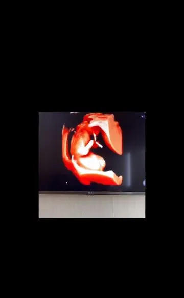 angbeen rishi umumkan kehamilan Instagram