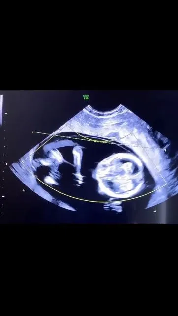 angbeen rishi umumkan kehamilan Instagram