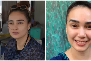 8 Penampilan Feby Febiola berambut plontos, 6 kali jalani kemoterapi