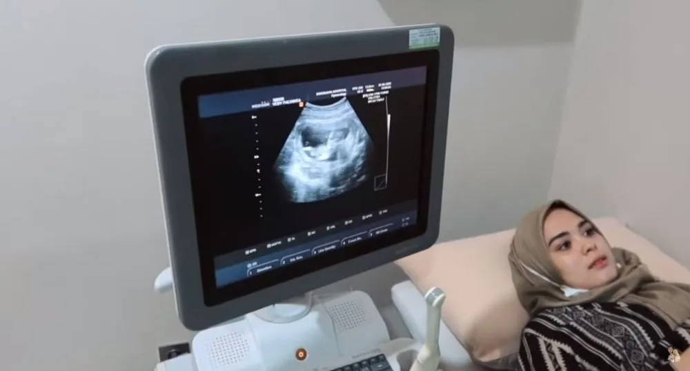 Vebby Palwinta umumkan kehamilan YouTube