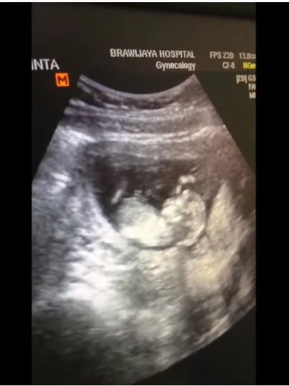 Vebby Palwinta umumkan kehamilan YouTube