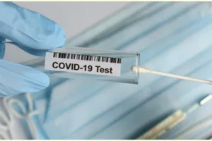 Ini syarat dan biaya ikut rapid test Covid-19, mudah dan cepat