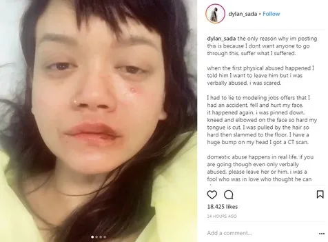 Dylan Sada meninggal © Instagram Dylan Sada meninggal © Instagram