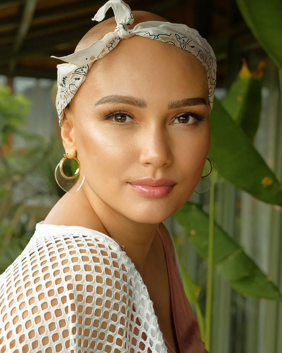 Feby sembuh kanker © Instagram