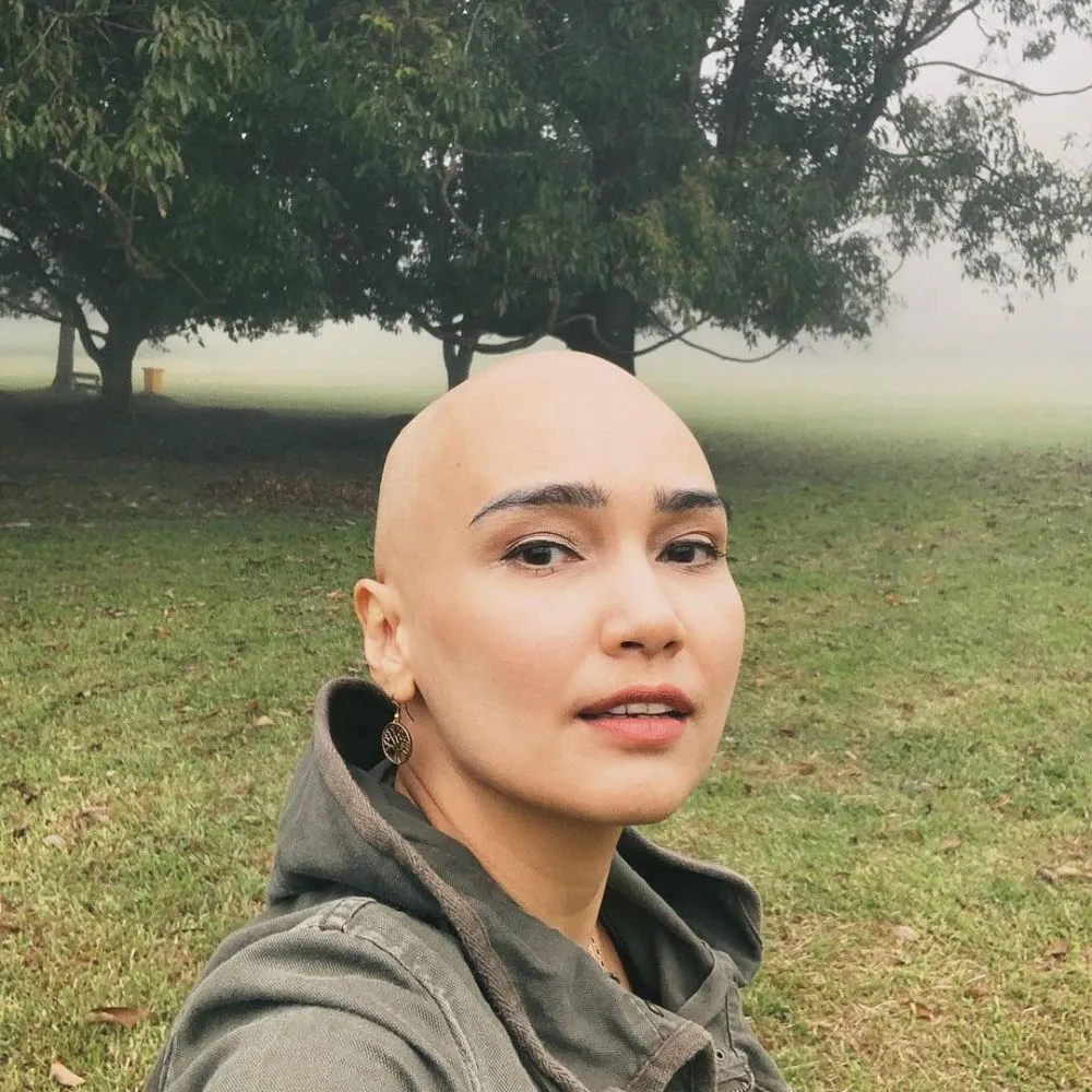 5 Fakta Feby sembuh © Instagram 5 Fakta Feby sembuh © Instagram