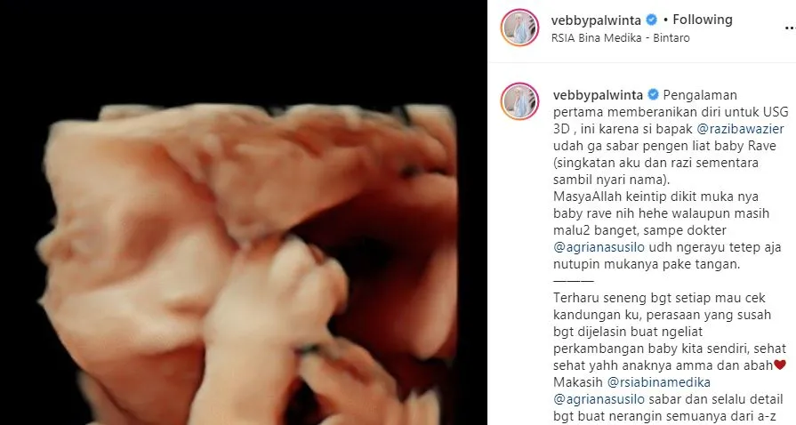 anak vebby mancung © Instagram anak vebby mancung © Instagram