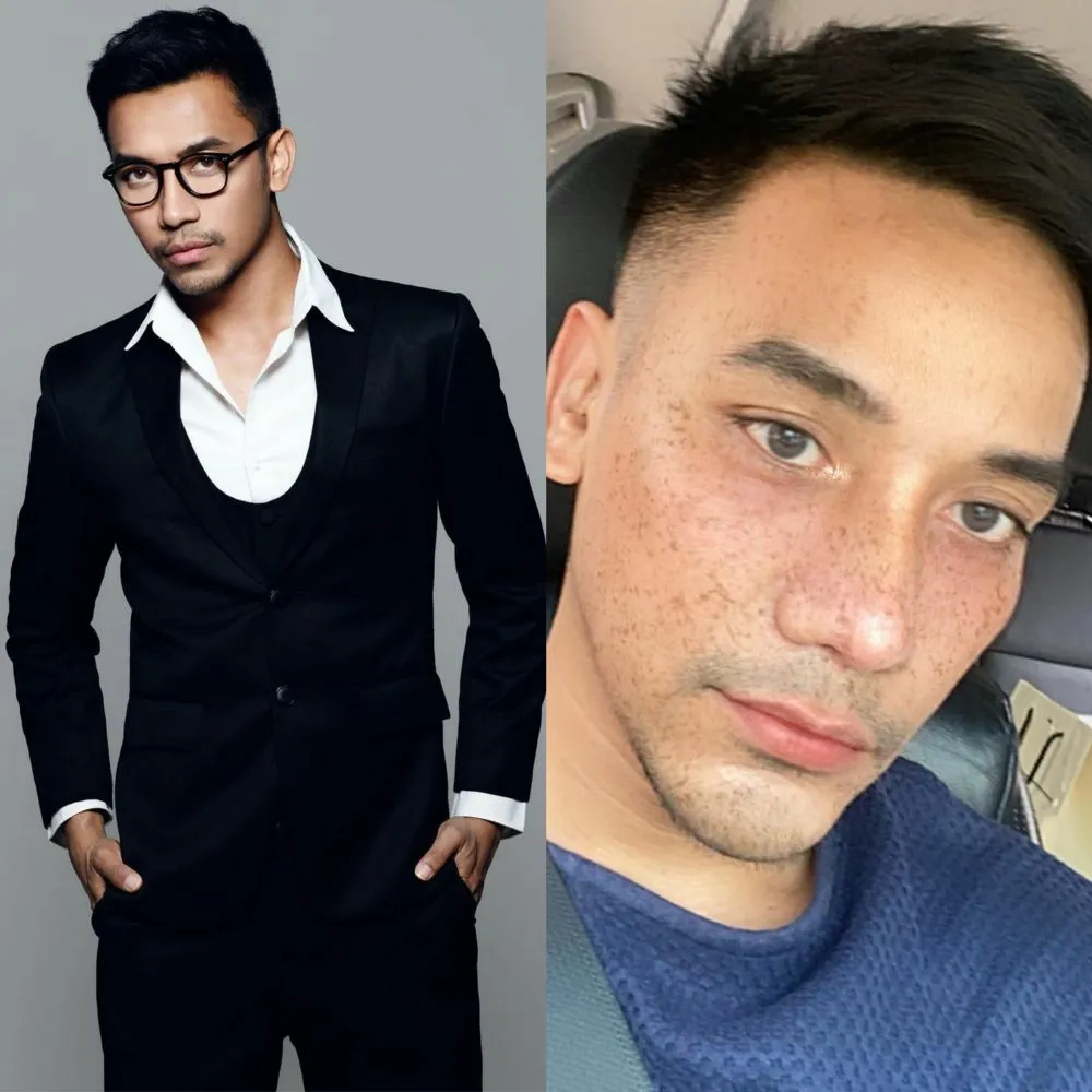 Potret seleb sesudah dan sebelum operasi plastik © 2020 brilio.net Potret seleb sesudah dan sebelum operasi plastik © 2020 brilio.net