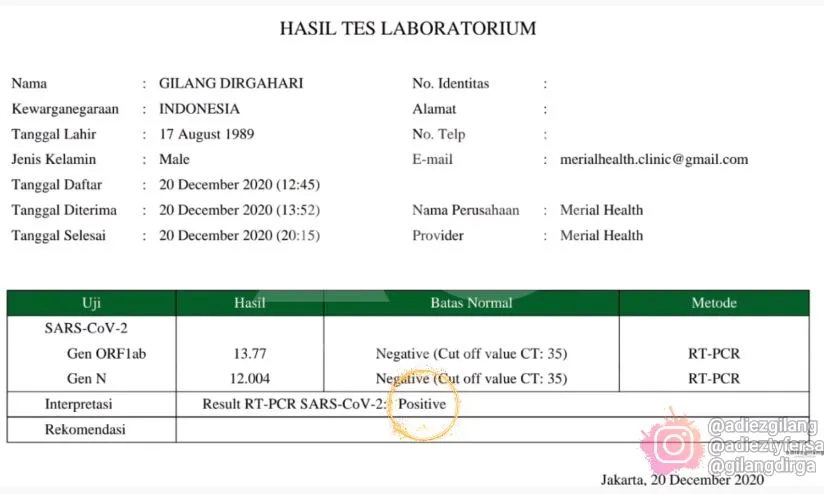 gilang dirga positif covid-19 © berbagai sumber gilang dirga positif covid-19 © berbagai sumber